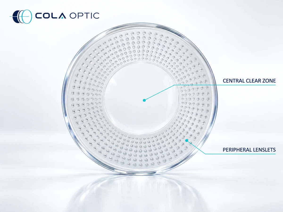 PC Myopia-Management Lenses: Separate the central and peripheral regions